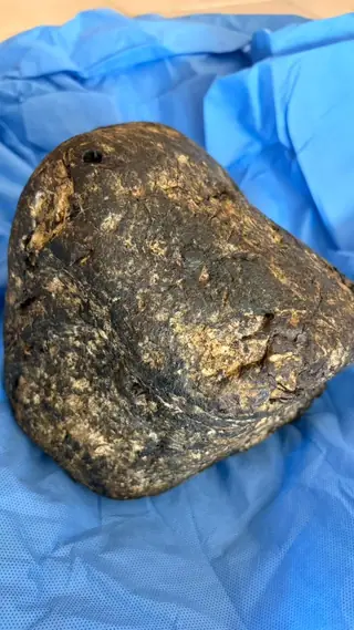 The dark brown ambergris piece from the side, a triangular profile with a small hole at the top