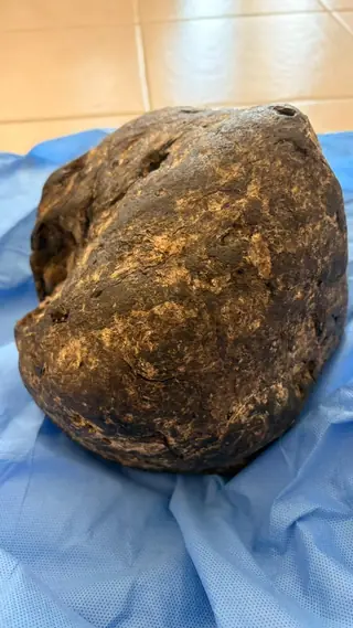 The back of the dark brown ambergris piece, with a ridge and a hole near the top